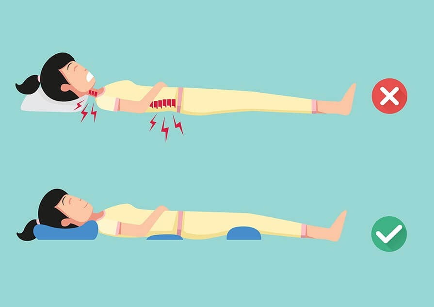 بعد از عمل دیسک گردن چه باید کرد؟